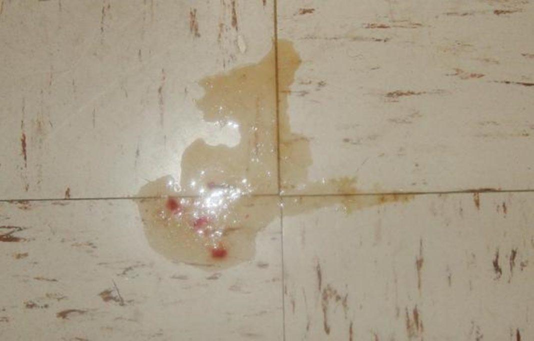 Manchas de Sangue na urina de cachorro, o que pode ser?