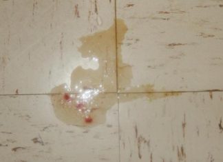 Manchas de Sangue na Urina e Urinando pouco. O que pode ser? Manchas de Sangue na urina de cachorro, o que pode ser?